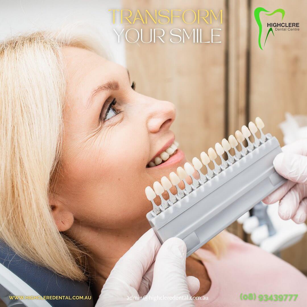 Marangaroo-Dentist-Highclere-Dental-Centre-Dental-Veneers Marangaroo Dentist Highclere Dental Centre Dental Veneers