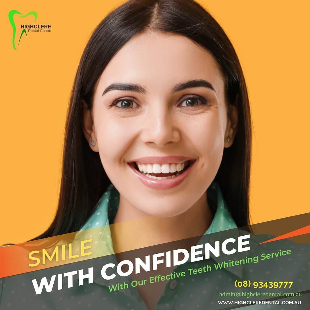 Marangaroo-Dentist-Highclere-Dental-Centre-Teeth-Whitening-Service Marangaroo Dentist Highclere Dental Centre Teeth Whitening Service